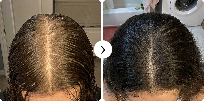 El crecimiento del cabello antes y después.